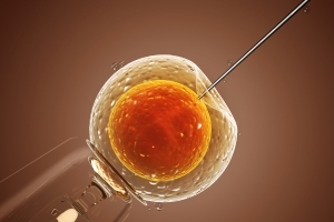 Inseminazione Intrauterina (IUI)