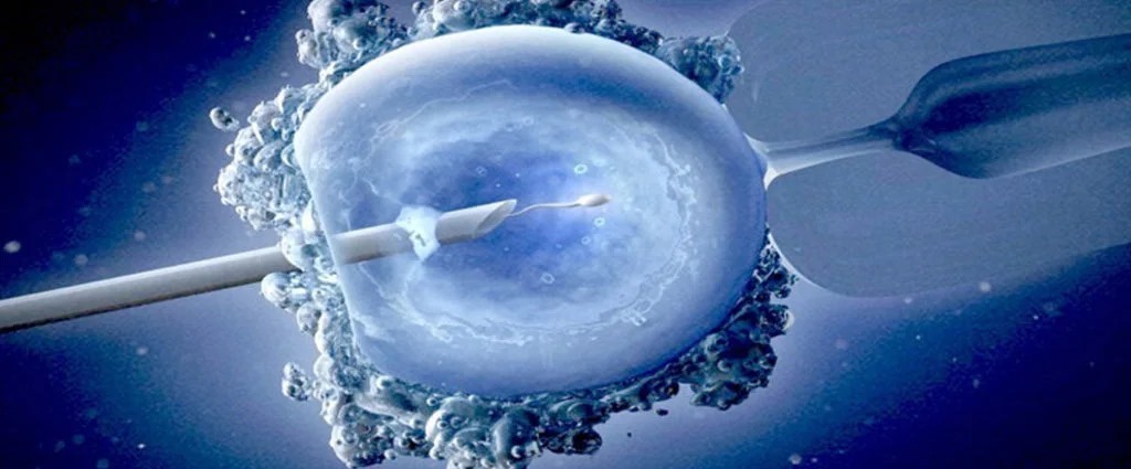 Laser Assisted Hatching